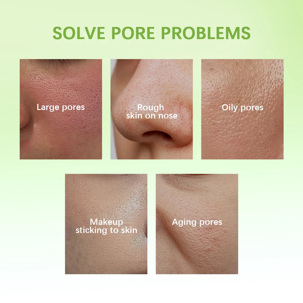 30ml Oil Control Pore Essence Milk Smoothes Pores And Moisturizes Skin With A Refreshing Non-greasy Essence Skin Care Products Peaceful Pleasures Health and Wellness