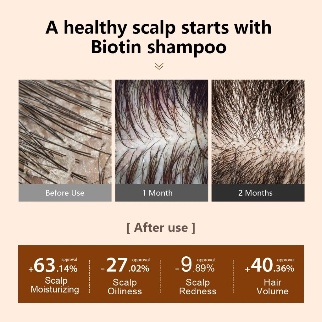 PURC Biotin Hair Growth Shampoo, Conditioner & Oil Set