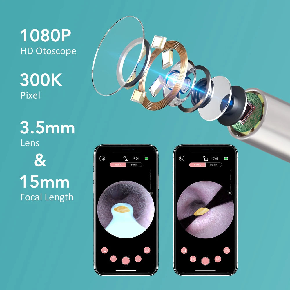 2 in 1 Visual Ear Wax Removal Tool with Camera and Tweezers 1080P HD WiFi Otoscope Reusable Ear Cleaner Kit for Kids Adults Pets Peaceful Pleasures Health and Wellness