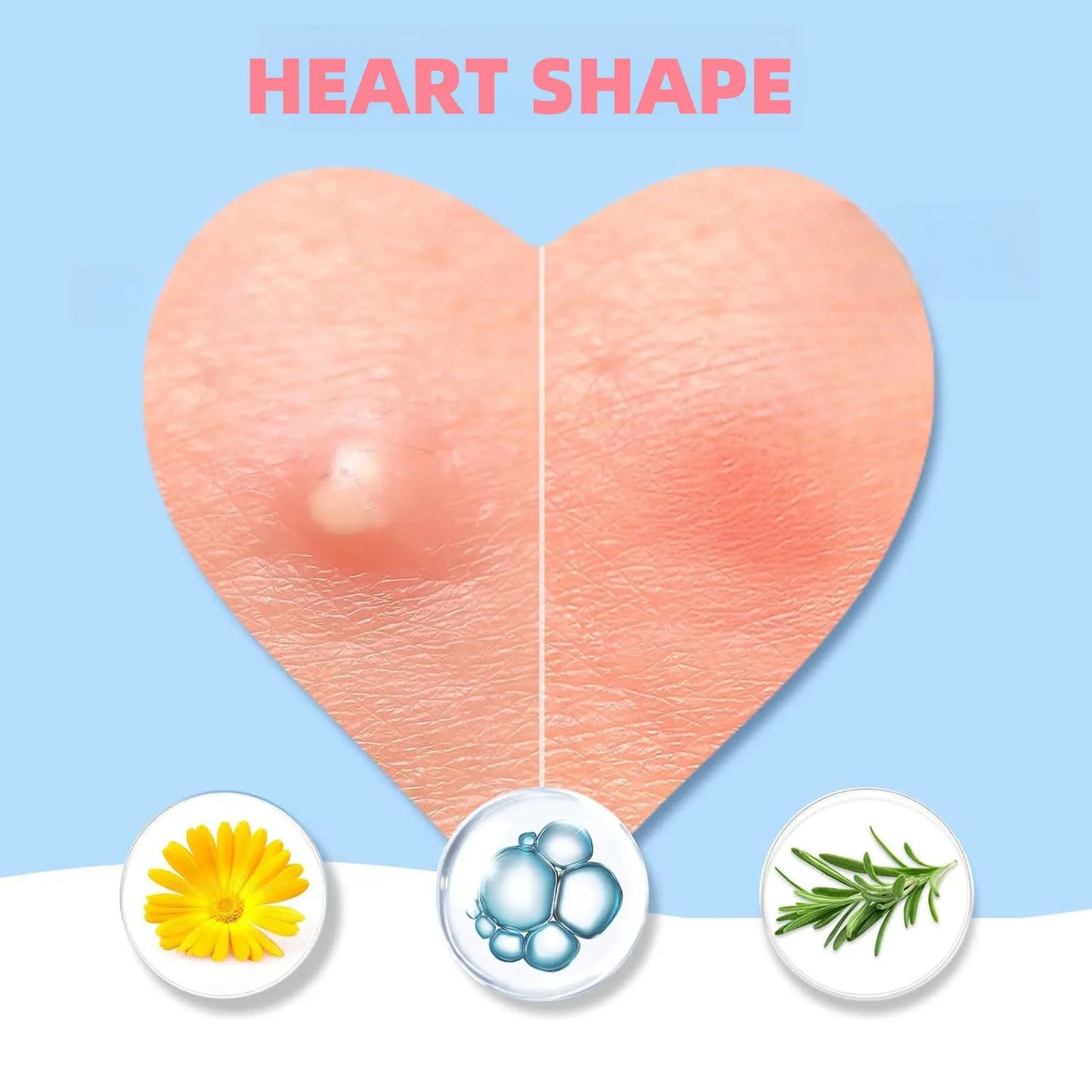 Invisible Waterproof Hydrocolloid Acne Patches – All Skin Types