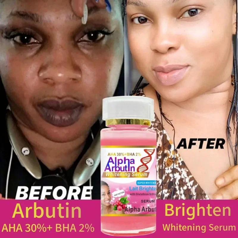 AHA 30% BHA 2% Brightening Serum Cream – Glutathione & Vitamin C