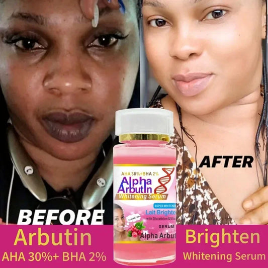 AHA 30% BHA 2% Brightening Serum Cream – Glutathione & Vitamin C Brightening Serum Cream Peaceful Pleasures Health and Wellness