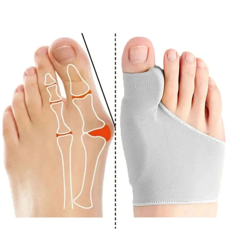 Hallux Valgus Corrector – Adjustable Big Toe Separator Pair