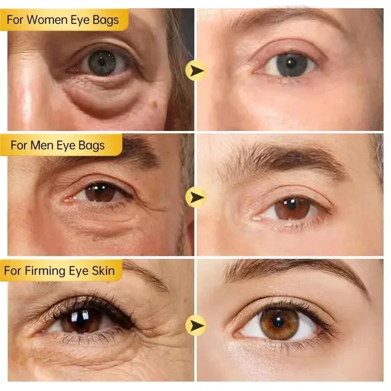Instant Eye Bag Removal Cream Retinol Anti-Wrinkle Lifting Firming Fade Fine Lines Anti Dark Circle Puffiness Brighten Eye Care Peaceful Pleasures Health and Wellness