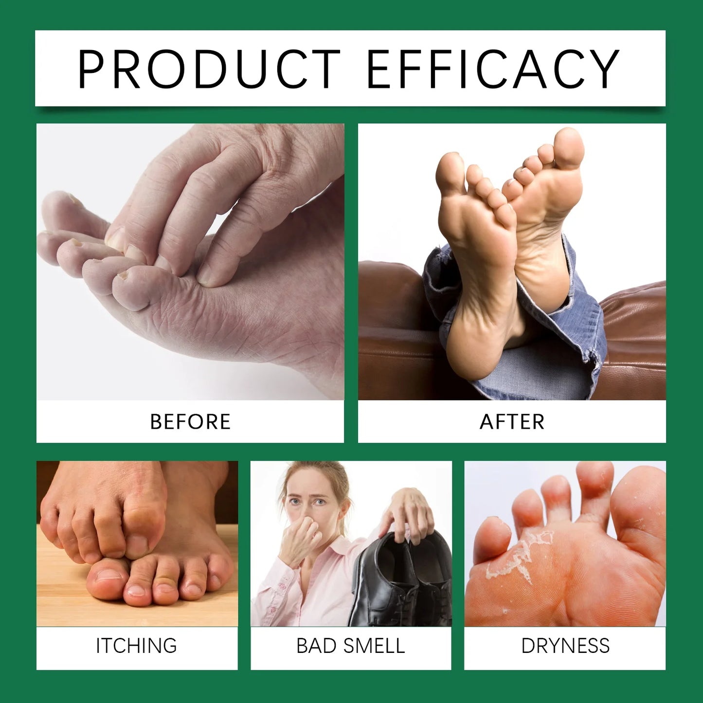 Foot Exfoliating Spray | Salicylic Acid & Allantoin 100ml