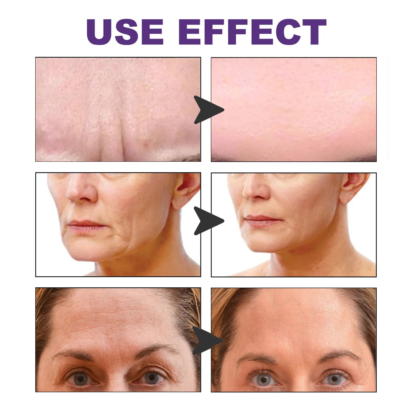 Collagen Cheek Patches – Firming, Hydrating & Smoothing Mask