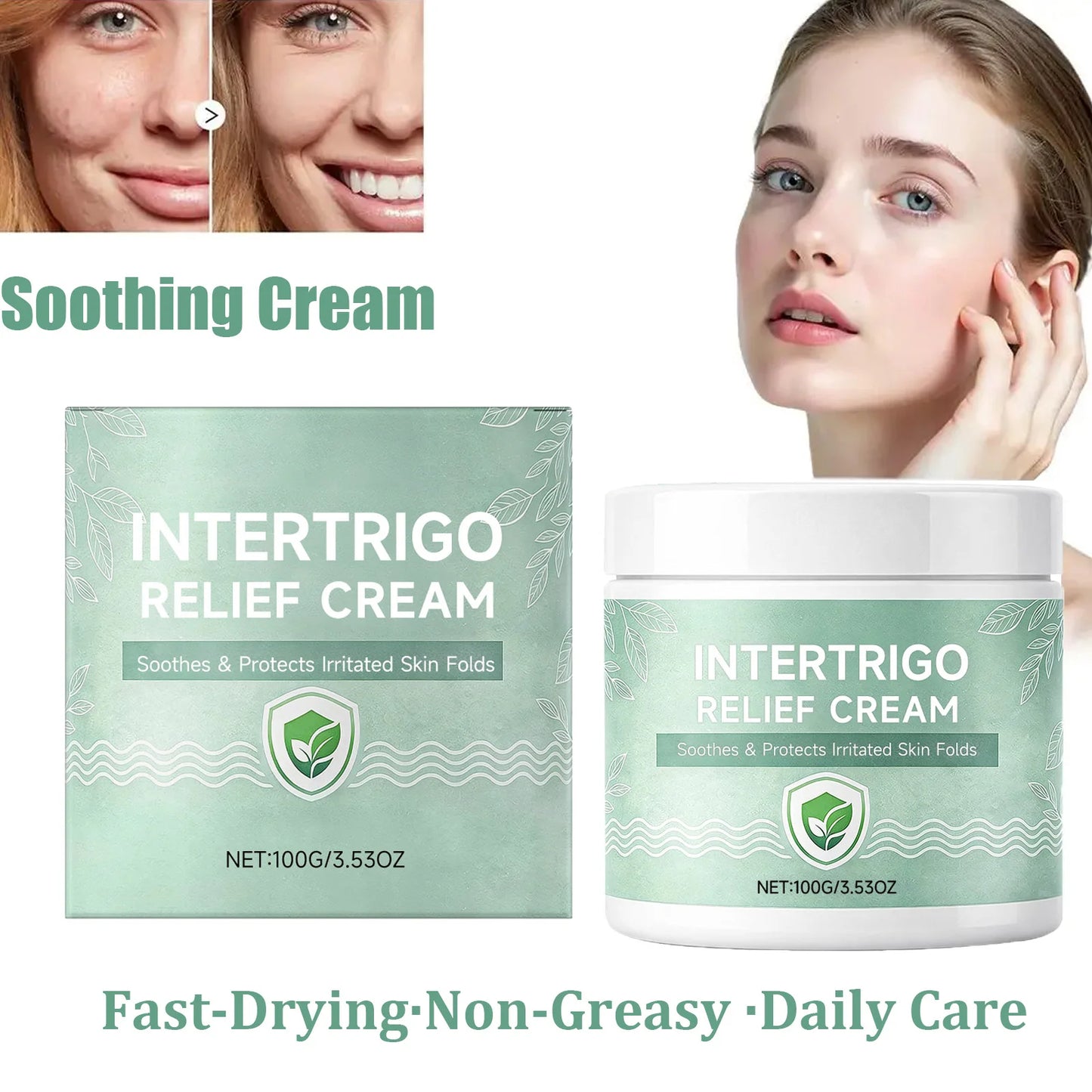 Skin Fold Soothing Cream – Intertrigo Relief & Barrier