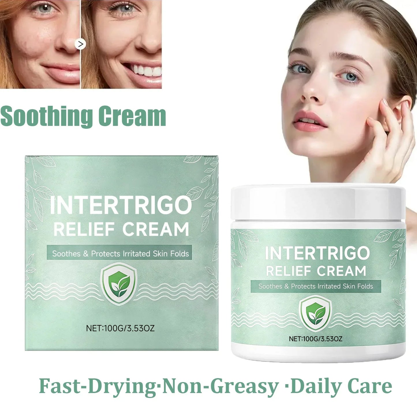 Hoygi Skin Fold Soothing Cream – Intertrigo Relief 100g