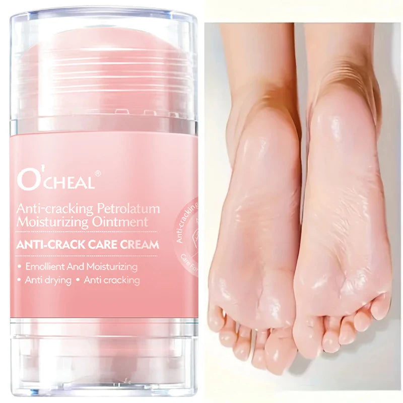2-Pack Anti-Crack Hand & Foot Cream for Dry & Cracked Skin