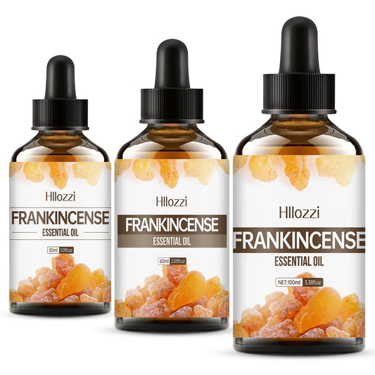 Frankincense Essential Oil 30/60/100ml – Aromatherapy & Massage Frankincense Essential Oil Oasis Select