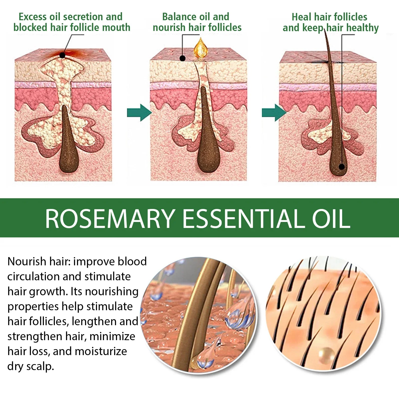 Jaysuing Rosemary Essential Oil Multi-Effect Nourish Shiny Hair Healthy Solid Hair Nourishing Thick Hair Skin Care Essential Oil Peaceful Pleasures Health and Wellness