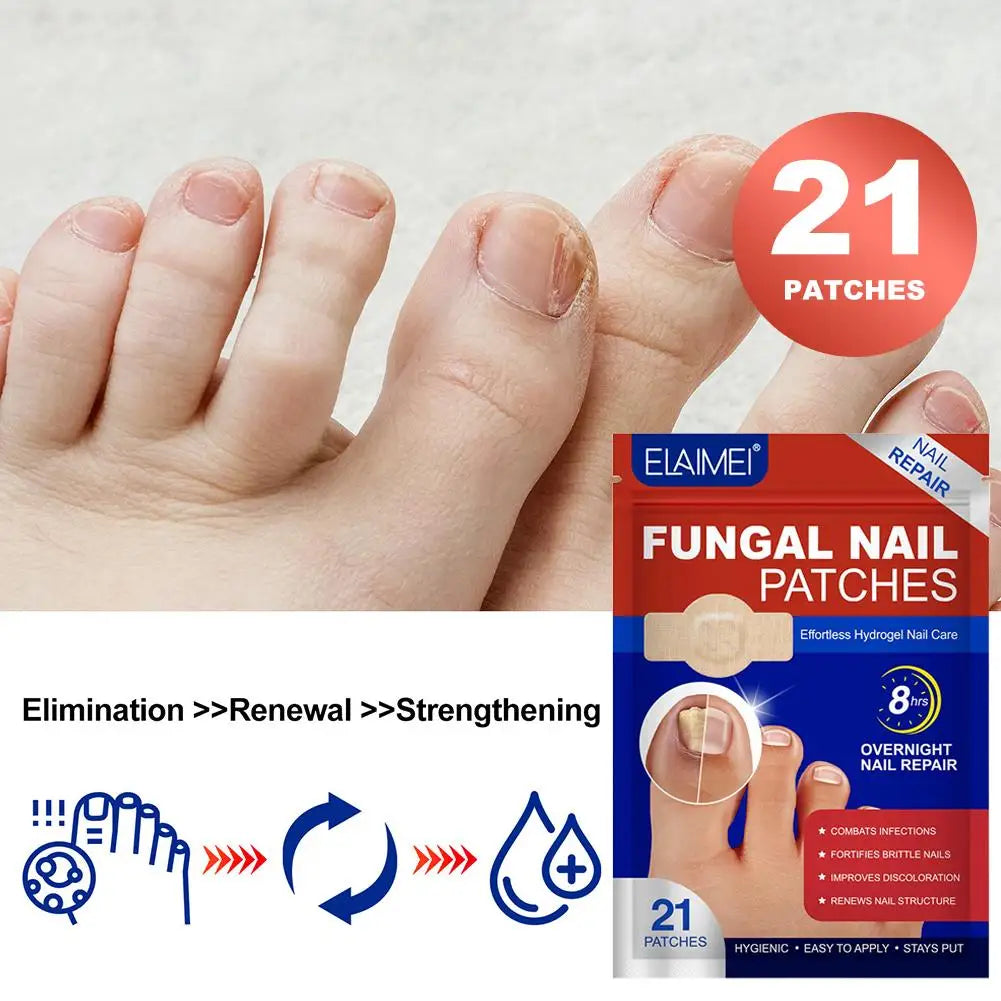 21pc Gray Toe Nail Sticker Fungal Nail Repair Patch Ingrown Correction Sticker Toenail Care Paronychia Nail Treatment Patch CarE Peaceful Pleasures Health and Wellness