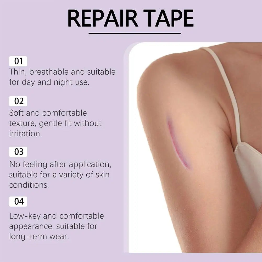 Silicone Scar Tape Roll – Self-Adhesive Scar Sheets for Surgical & Burn Scars Peaceful Pleasures Health and Wellness