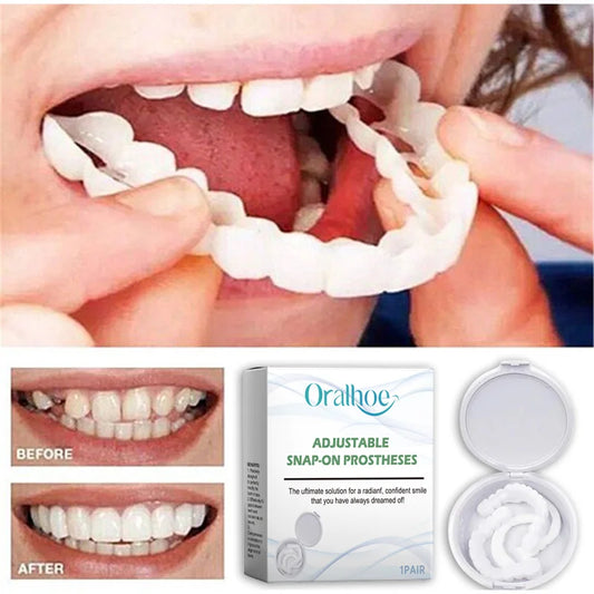 Adult Adjustable Dentures Teeth Set Adjustable Snap-on Fake Teeth Comfort Natural Fit Portable Braces Easy Clean Use Adhesives Peaceful Pleasures Health and Wellness