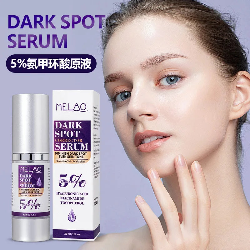 Dark Spot Remover for Face,Dark Spot Corrector Serum for Age Spot Sun Spot Freckles Melasma Brown Spot Skin Care Repair Cream Peaceful Pleasures Health and Wellness