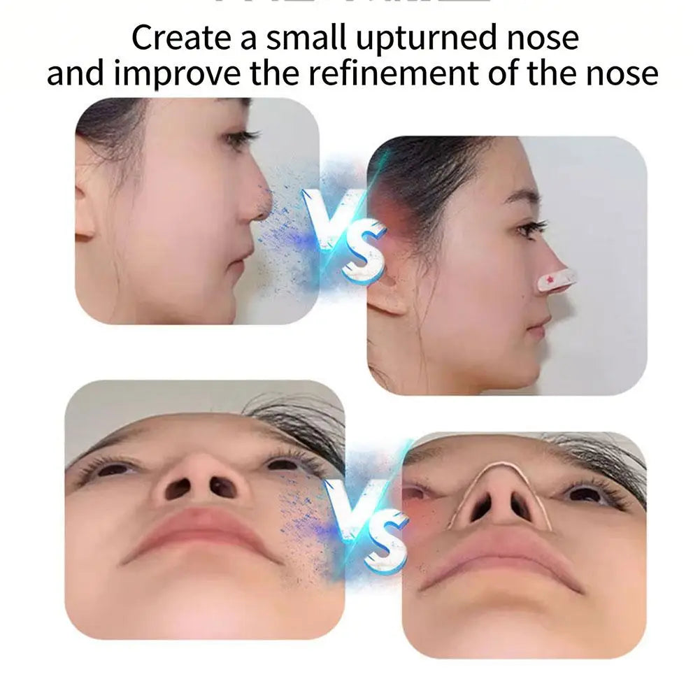 Nose Lift Reshaping Patches – Reusable Lifting Strips 10-Pack