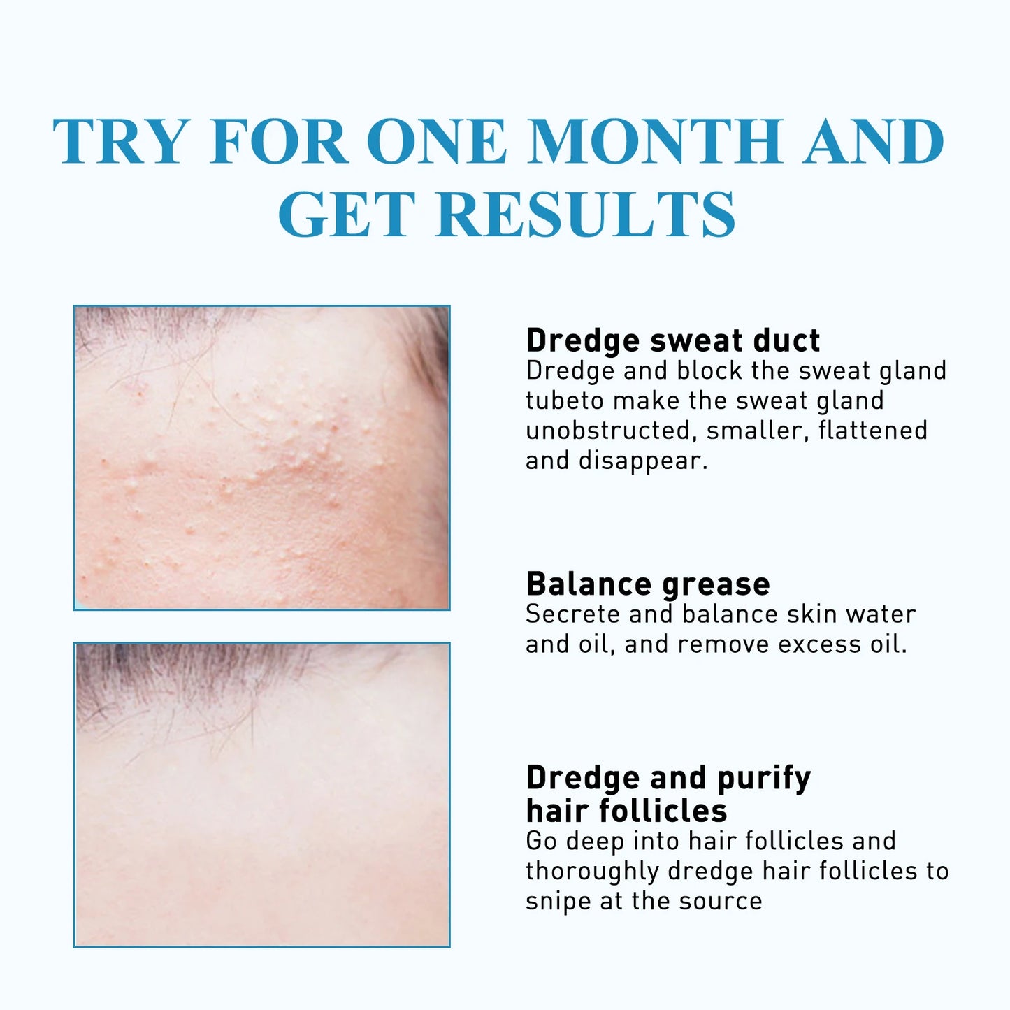South Moon 144pc Hydrocolloid Blemish Patches | Salicylic & Cica