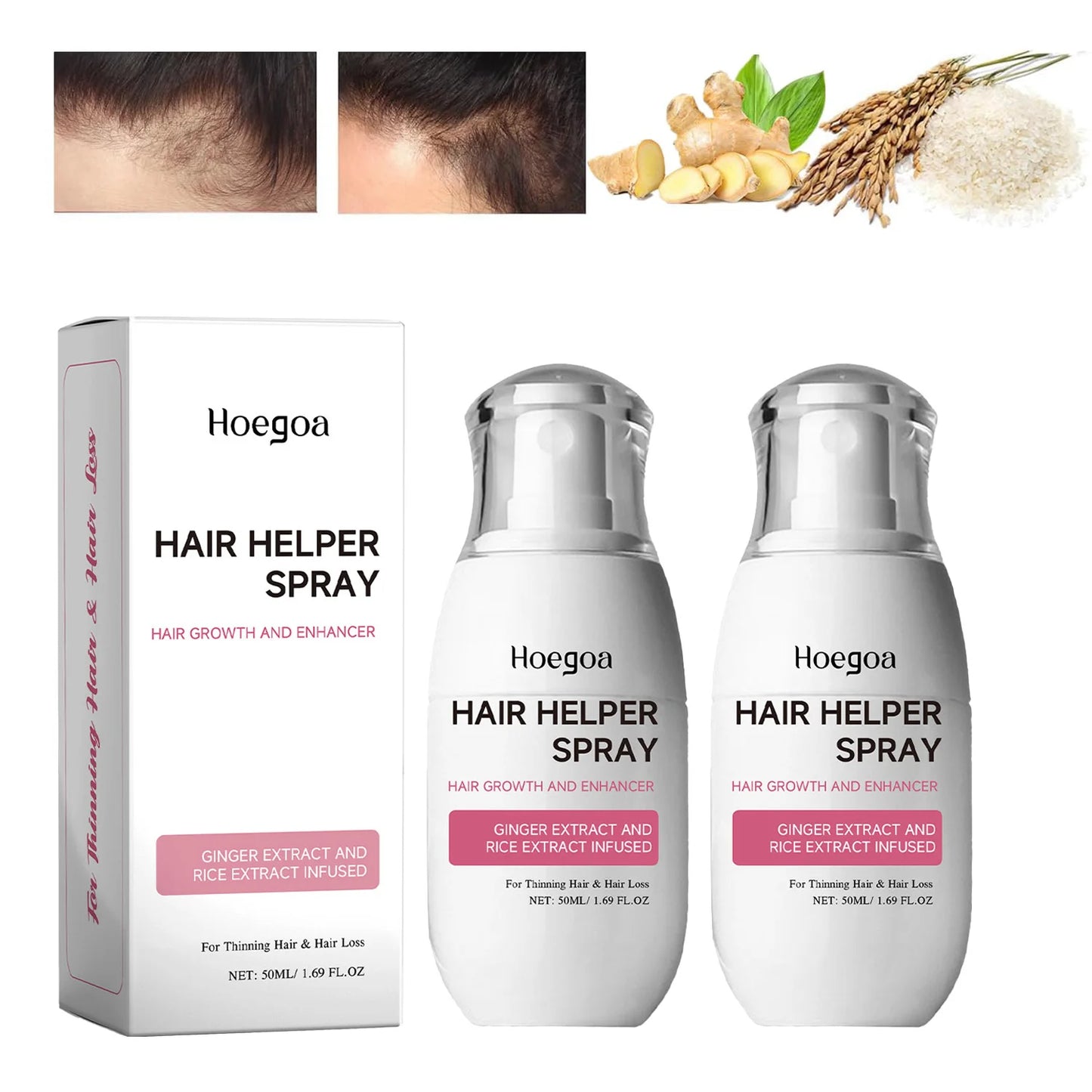 HOEGOA Biotin Ginger Hair Growth Spray – Anti Hair Loss 50ml