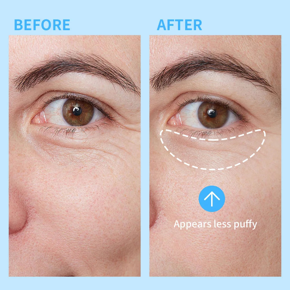 Lakerain Hydration Eye Gel Deep Hydrating Brightening Reduce Dark Circles Cool Feeling Transparent Gel Suitable for All Skin Peaceful Pleasures Health and Wellness