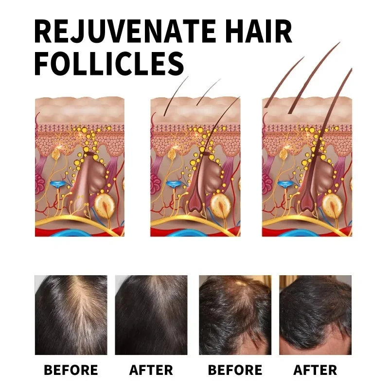 Hair Growth Serum Fast Growing Hair Essential Oil Beauty Hair Care 30ml Dense Regrowth Ginger Hair Promoting Regeneration Peaceful Pleasures Health and Wellness