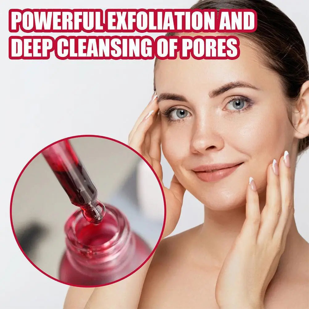 Eelhoe Salicylic Acid Pore Minimizer Serum – Acne & Blackhead