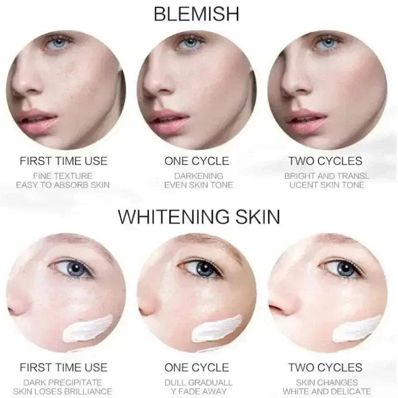 1/3/5pcs Whitening Freckle Cream Niacinamide Remove Dark Spot Cream Anti Freckle and Aging Cream Fade Pigmentation Melasma Skin Peaceful Pleasures Health and Wellness