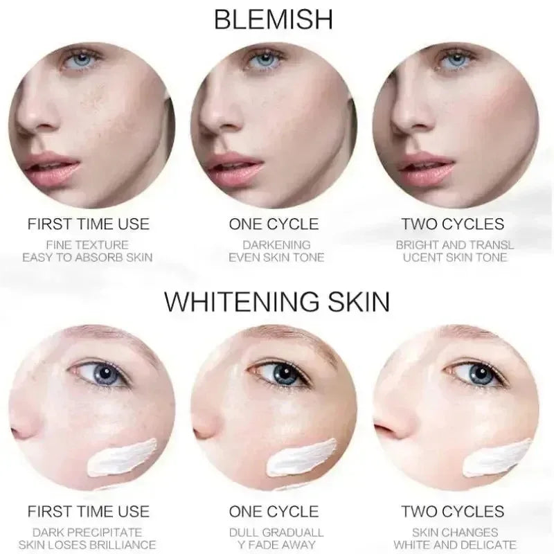 Niacinamide Dark Spot & Freckle Whitening Cream – 20g