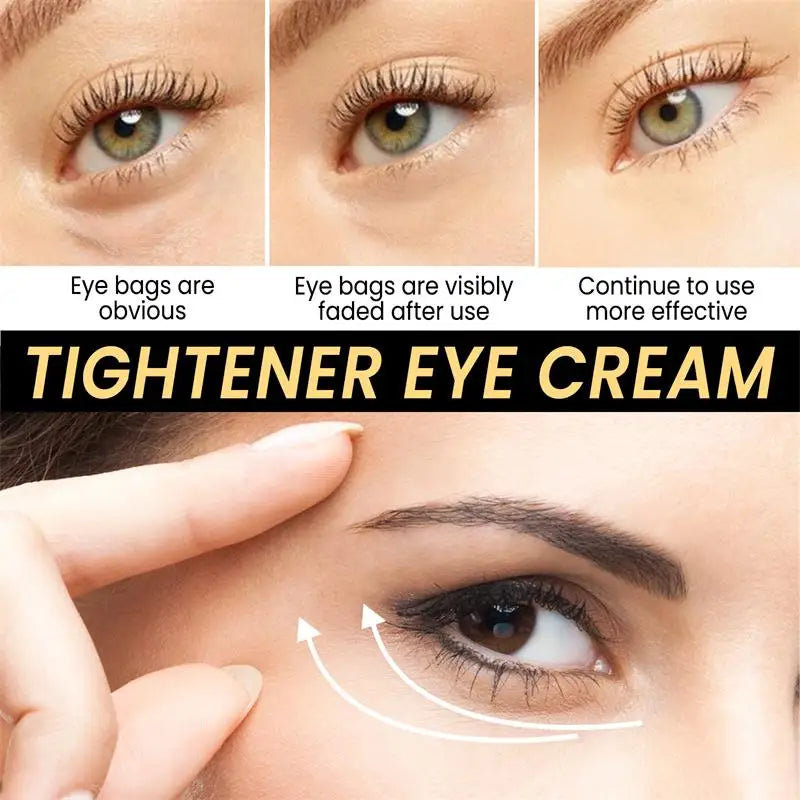 SADOER Snail Eye Cream – Dark Circles, Bags & Anti-Aging