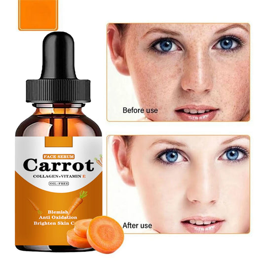 New Carrot Essence Essential oils Dark Spot Corrector Face Whitening Serum Brighten Blemish Freckle Remover 100% Natural Peaceful Pleasures Health and Wellness 30ml