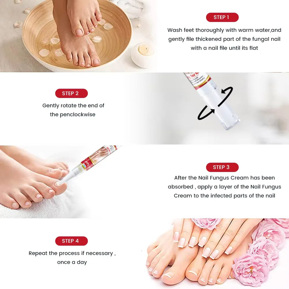 Fungal Nail Treatment Serum Foot Nail Fungus Removal Repair Gel Anti Infection Paronychia Onychomycosis Foot Nails Care Essence Peaceful Pleasures Health and Wellness