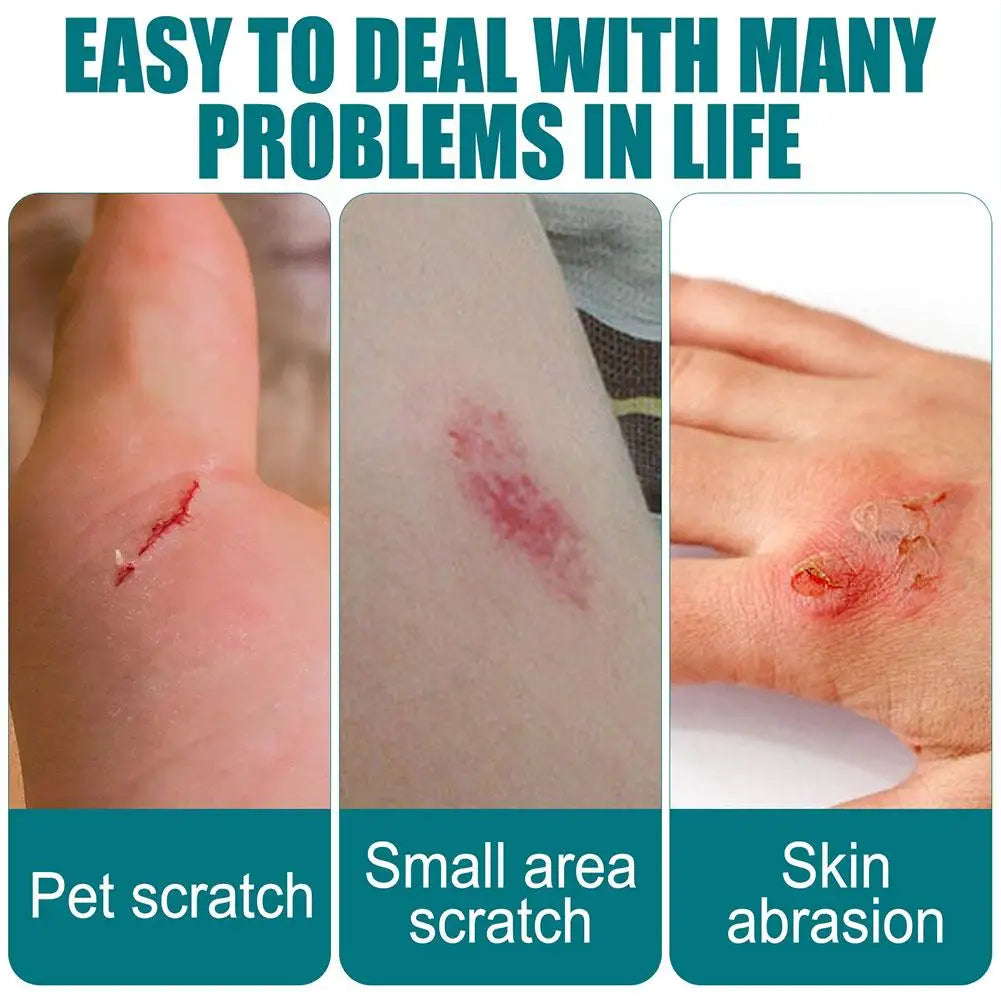 Waterproof Liquid Bandage Wound Care Spray – Breathable Healing Gel Peaceful Pleasures Health and Wellness