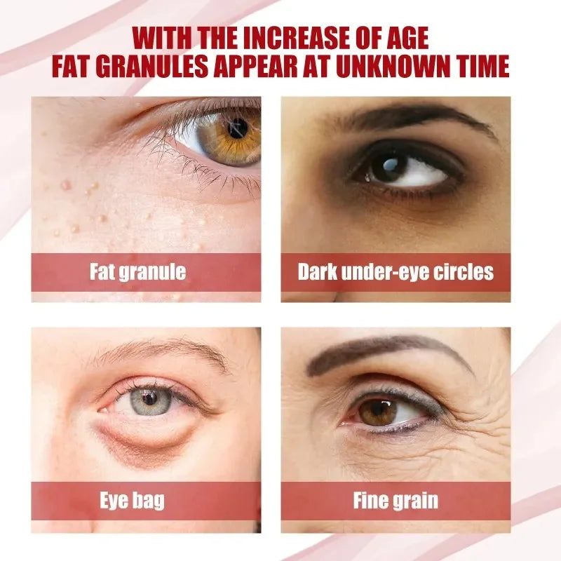 Hoygi Eye Cream | Dark Circles, Puffiness & Fine Lines