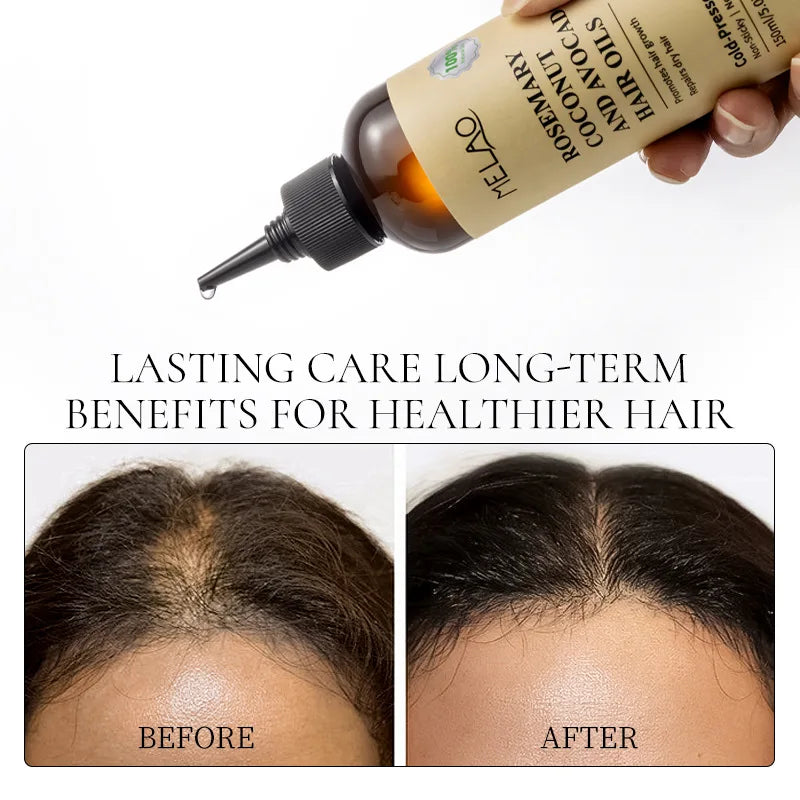 150ml Rosemary Coconut And Avocado Hair Scalp Treatment Hair Growth Oil Nourishing Hair Serum for Shine Strength All Hair Types Peaceful Pleasures Health and Wellness