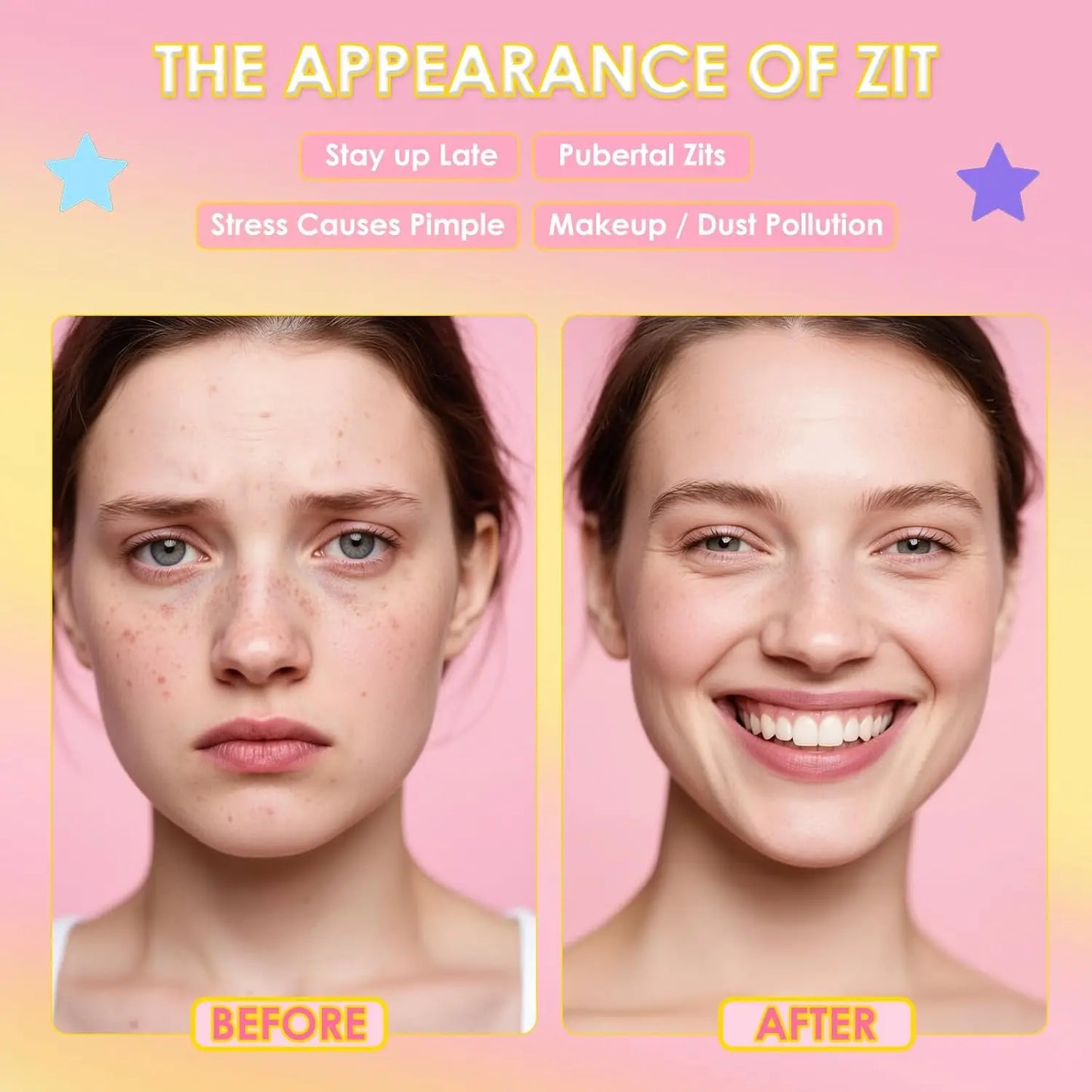 Hydrocolloid Acne Patches – Invisible, Waterproof, All Skin Types