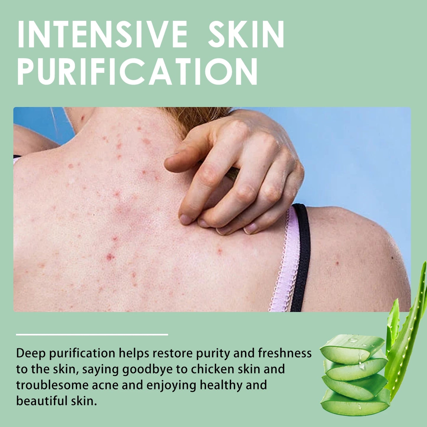 Keratosis Pilaris Repair Cream | Chicken Skin Body Lotion 48g