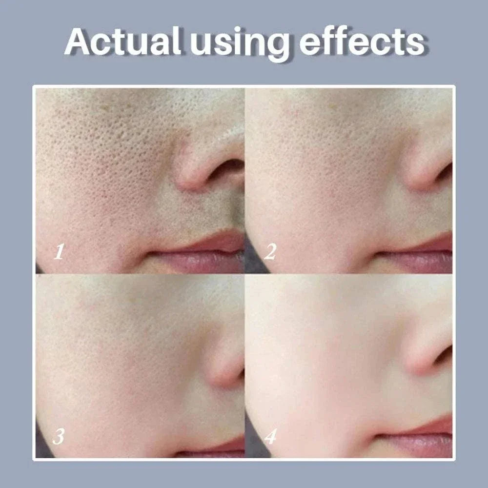 Pore Refining Facial Serum with Retinol & Niacinamide – 10mL