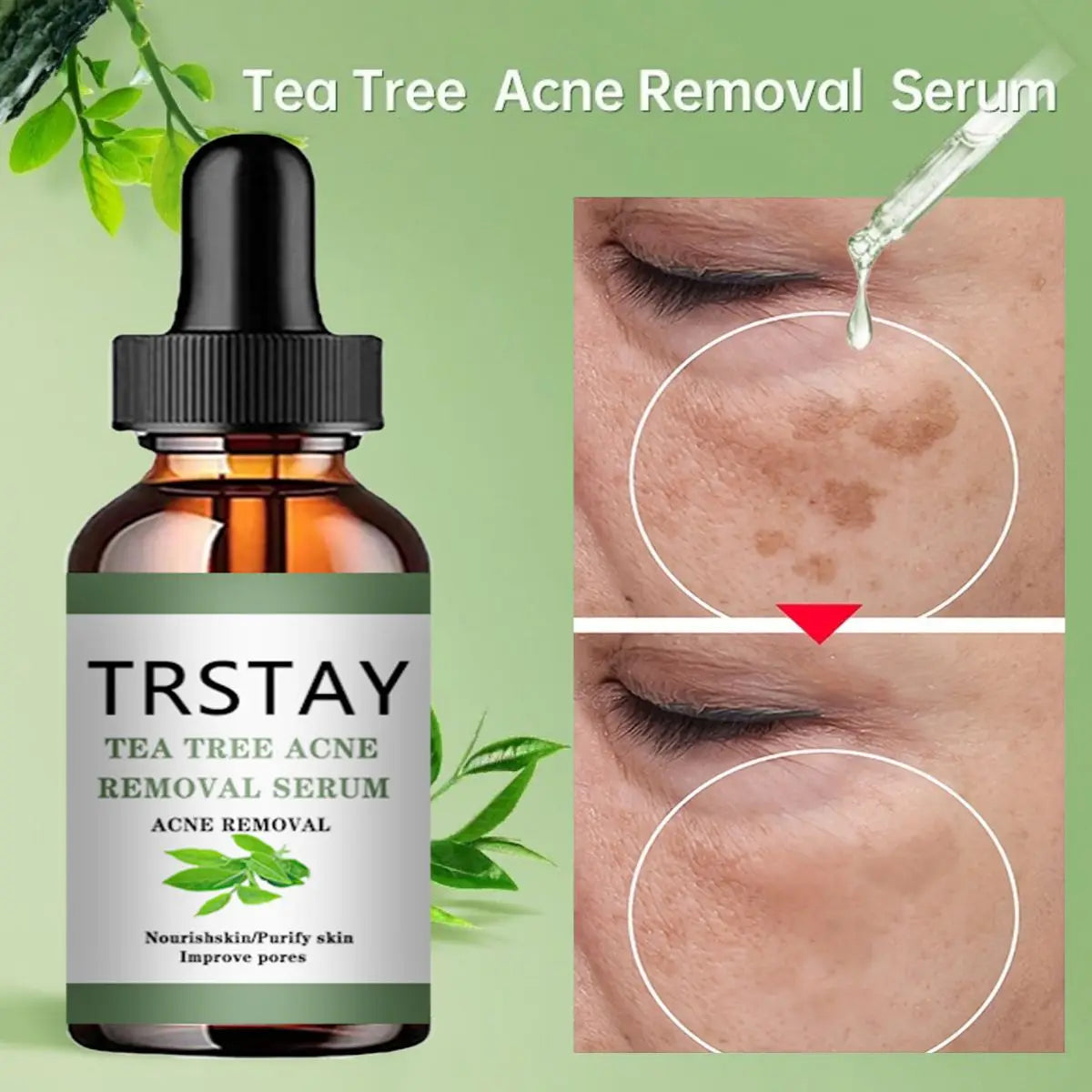 Acne Treatment Face Serum Tea Tree Oil Essence Moisturizing Shrink Pores Acne Facial Serum Korean Skin Care Products Peaceful Pleasures Health and Wellness