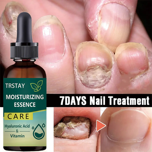 7DAYS Nail Repair Essence Gel – Toe & Foot Care Serum Nail Repair Serum Oasis Select 15ml
