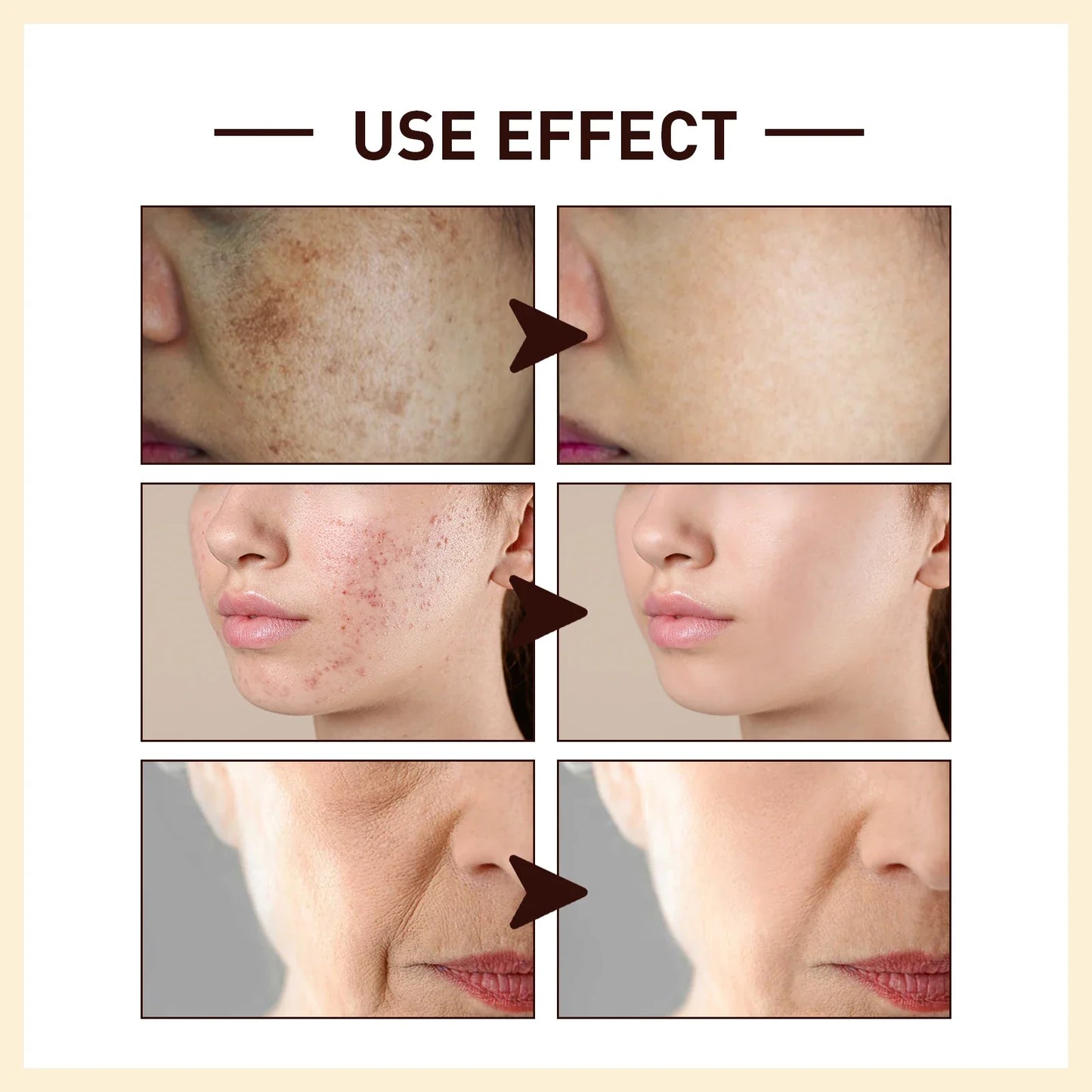 Rice Extract Anti-Wrinkle Face Serum – Hydrating & Firming