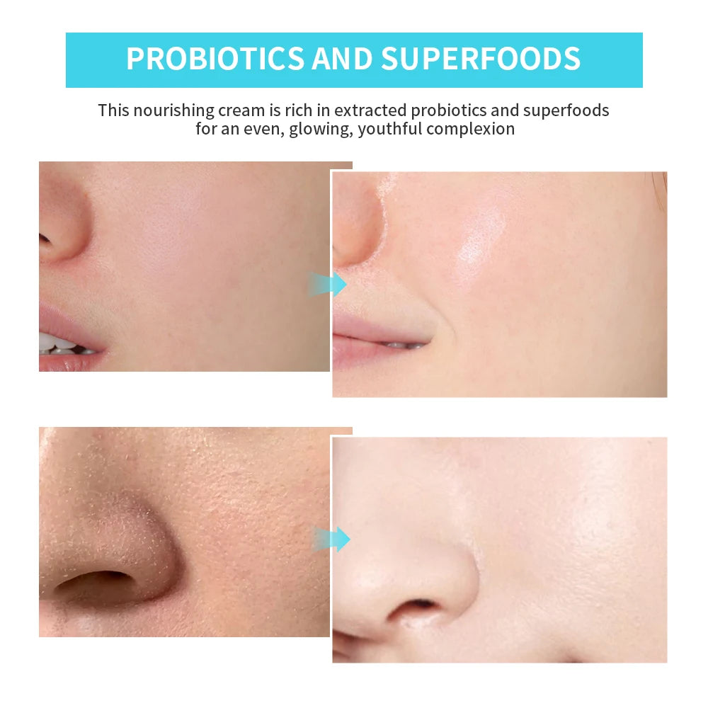 Probiotics Hydrating Cream Long-lasting Moisture Solve Dry Dull Skin Reduce Fine Lines Improve Skin Elasticity Skin Care Product Peaceful Pleasures Health and Wellness