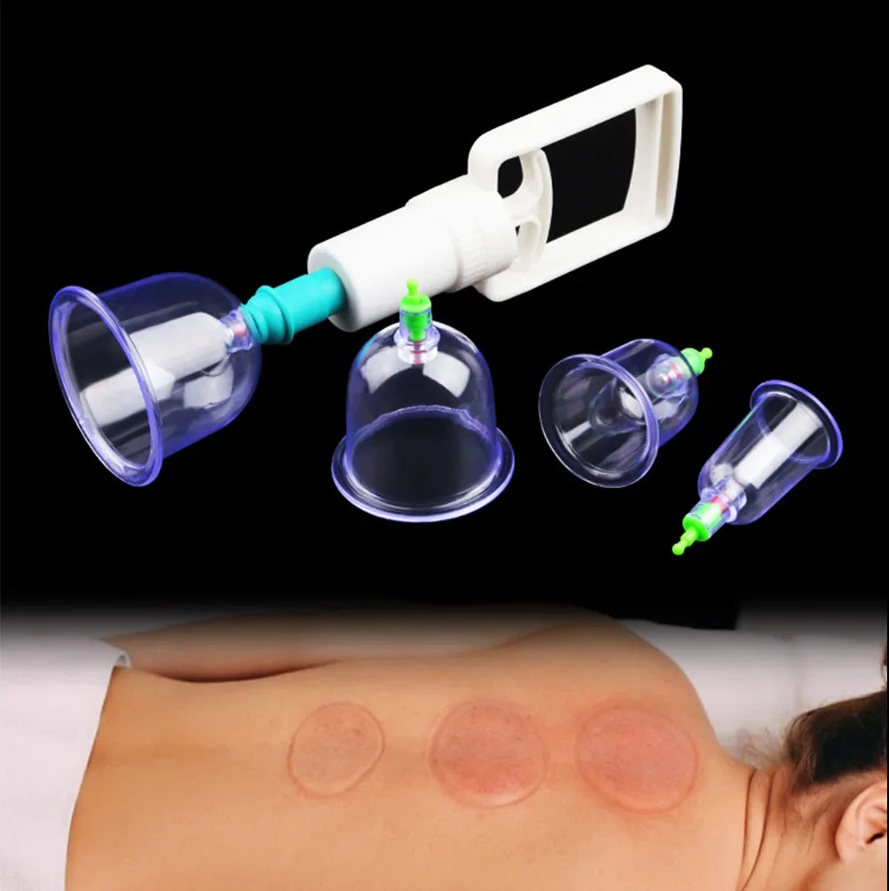 6-Piece Vacuum Cupping Set with Pump Gun – Anti-Cellulite
