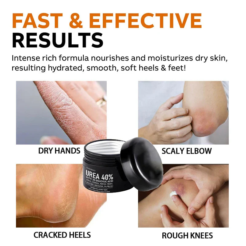 YURHERSU 40% Urea Foot Cream – Deep Moisturizing Heel Repair