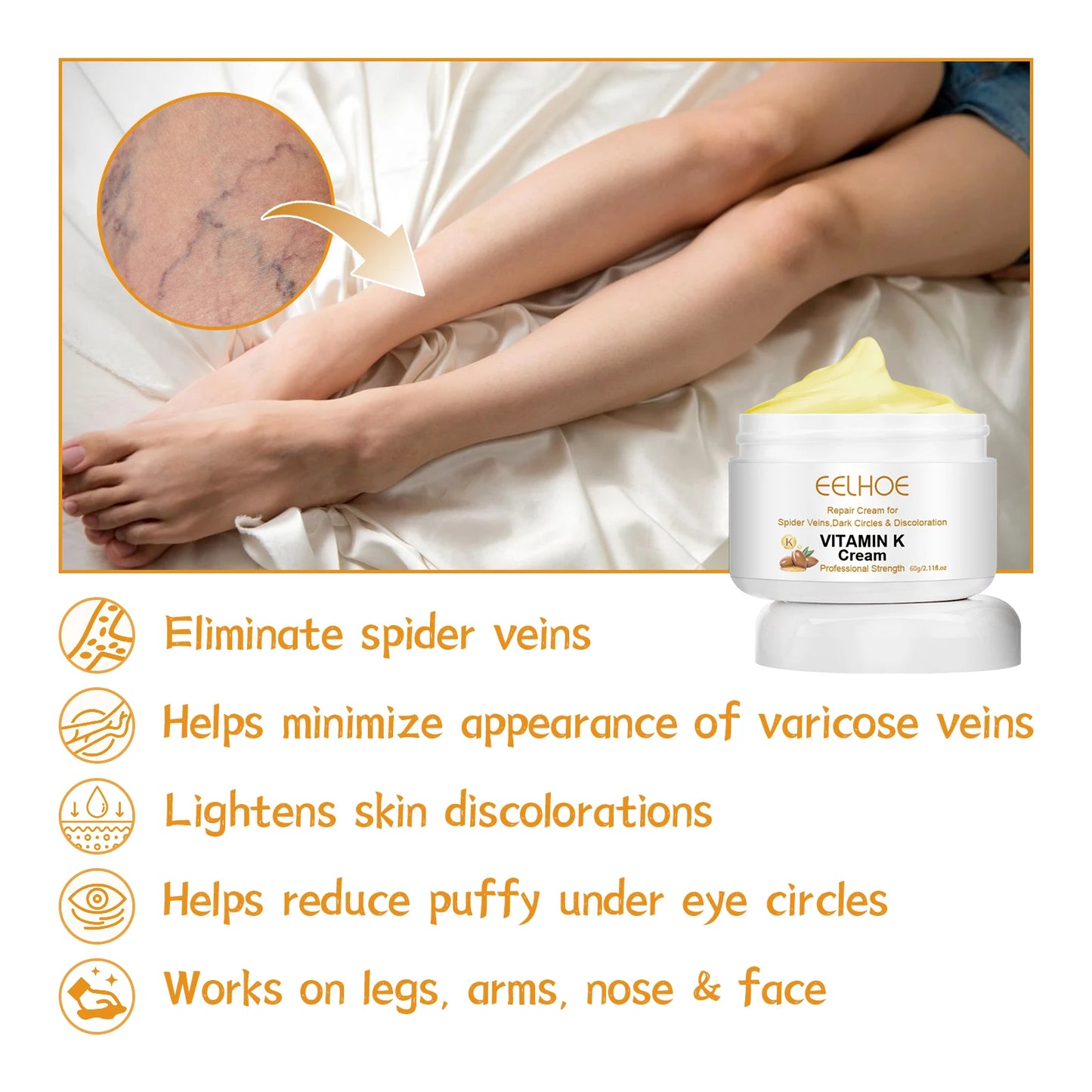 Vitamin K Cream for Varicose Veins, Spider Veins & Leg Relief