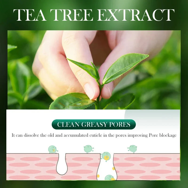 Tea Tree Acne Removing Cream Facial Mild Moisturizing Oil Control Acne Removing Facial Gel Eliminate Acne Pimples Beauty Health Peaceful Pleasures Health and Wellness