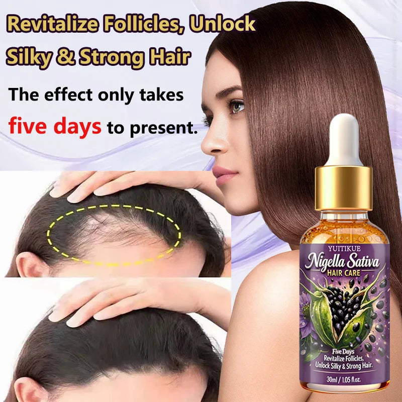YUITIKUE Nigella Sativa Hair Care Oil | 5 Days Formula To Revitalize Follicles | For Silky, Strong & Healthy Hair 30ml Peaceful Pleasures Health and Wellness