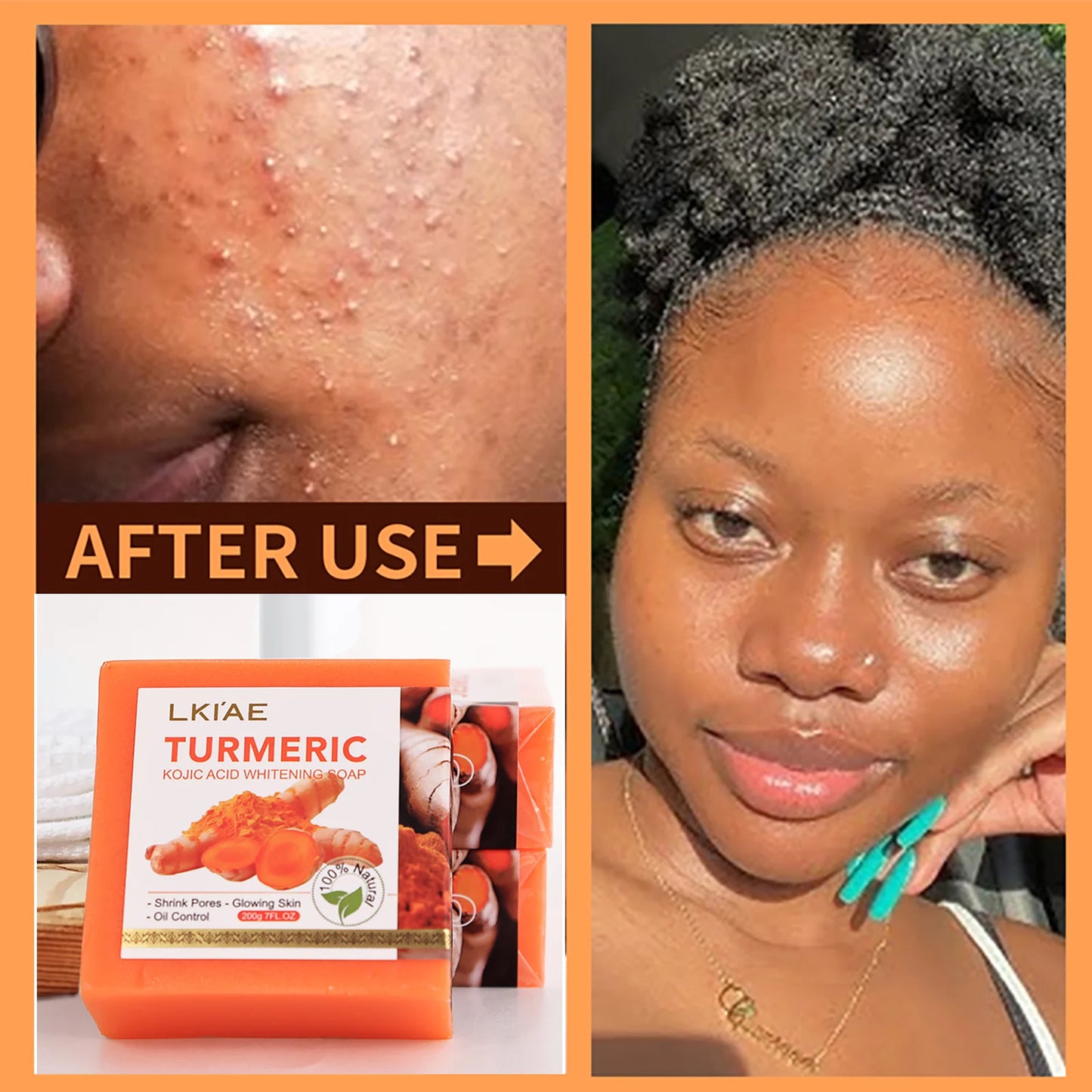 AILKE Turmeric & Glutathione 4-in-1 Brightening Skin Care Set