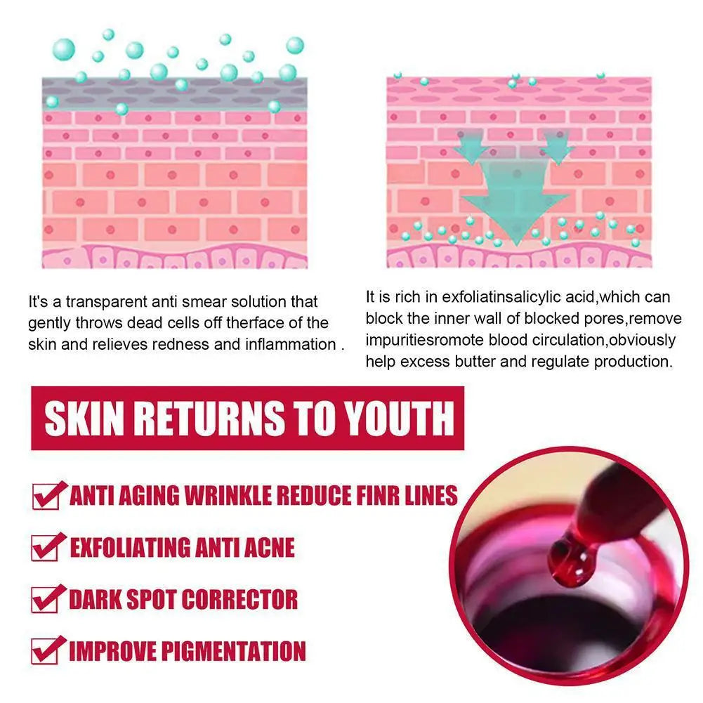30ml Salicylic Acid Shrink Pores Serum Moisturizing Nourishing Smooth skin Essence reduce Acne Blackhead Skin care for Women Peaceful Pleasures Health and Wellness