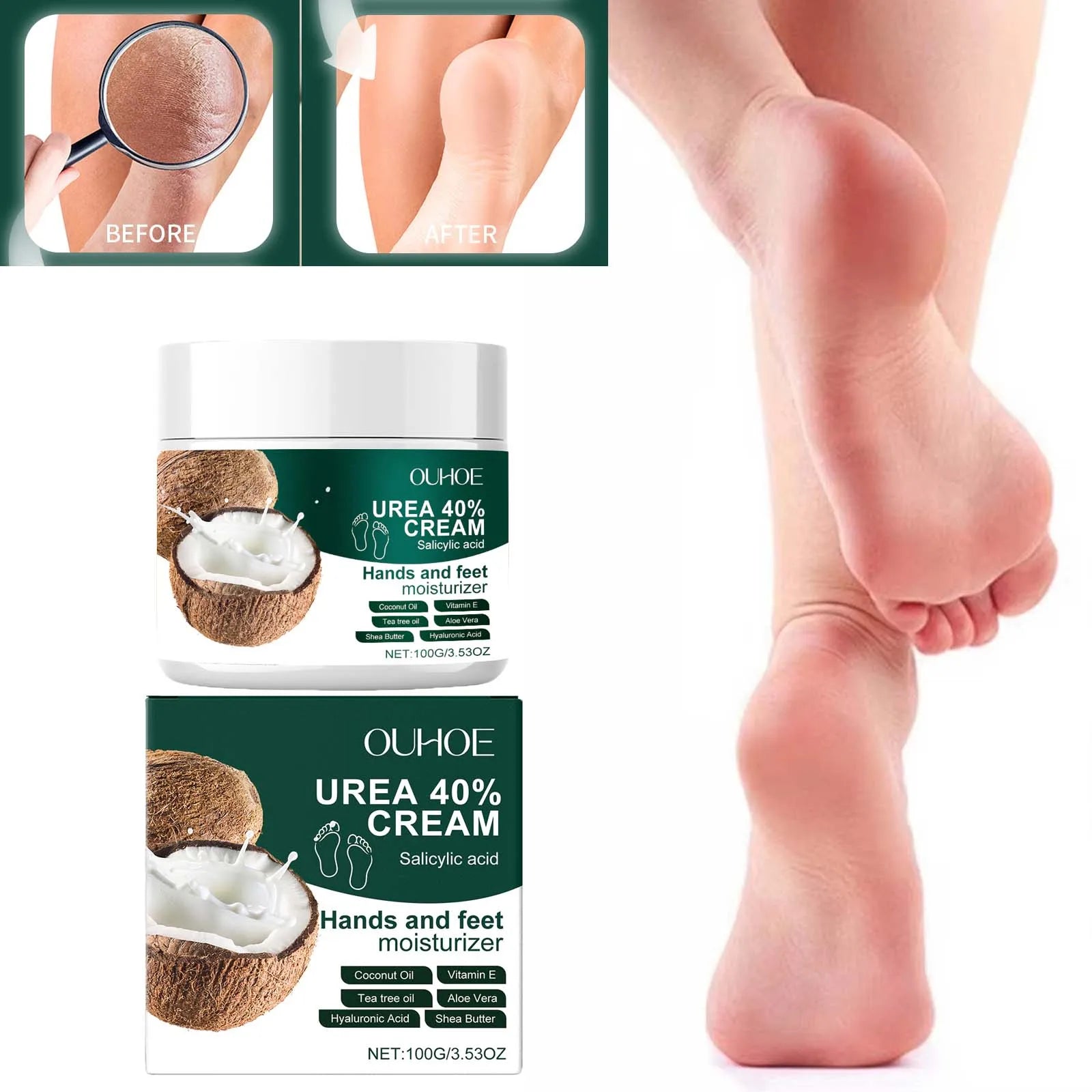 Urea 40% Cream Salicylic Acid Hand Foot Cream for Cracked Heels & Dry Skin Moisturizing Hydrating Callus Remover Smooth Skin Peaceful Pleasures Health and Wellness