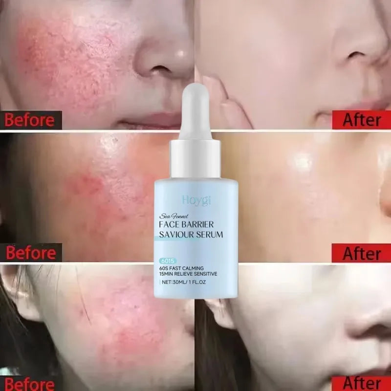 EELHOE Redness Repair Serum – Rosacea & Sensitive Skin Serum