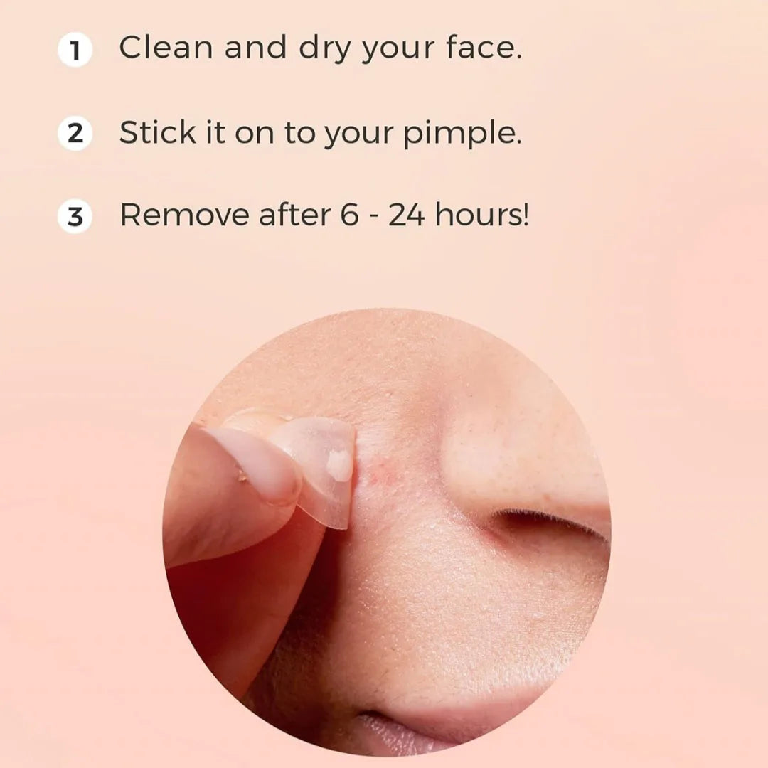 Invisible Waterproof Hydrocolloid Acne Patches – All Skin Types